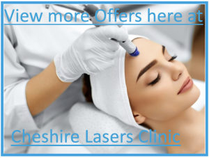 Cheshire Lasers offers
