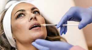 lip rejuvenation and enhancement Cheshire middlewich